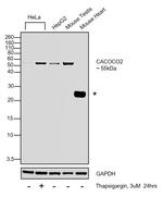 CALCOCO2 Antibody in Western Blot (WB)