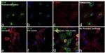 IL-8 (CXCL8) Antibody