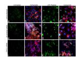 CXCL2 Antibody in Immunocytochemistry (ICC/IF)