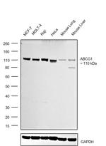 ABCG1 Antibody in Western Blot (WB)
