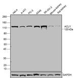 ATP Citrate Lyase Antibody in Western Blot (WB)