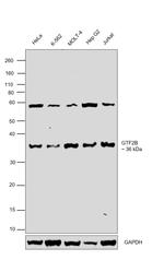 GTF2B Antibody in Western Blot (WB)