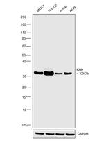 KHK Antibody in Western Blot (WB)