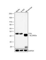 CTH Antibody in Western Blot (WB)