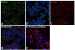 DNM1L Antibody in Immunocytochemistry (ICC/IF)