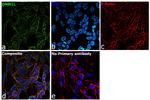 DNM1L Antibody in Immunocytochemistry (ICC/IF)