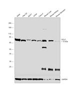 GCLC Antibody in Western Blot (WB)