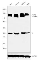 FGFR3 Antibody in Western Blot (WB)