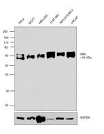 GBA Antibody in Western Blot (WB)