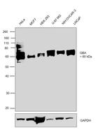 GBA Antibody in Western Blot (WB)