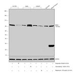 RRM1 Antibody