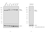 HDAC9 Antibody in Western Blot (WB)