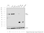 ALOX5 Antibody in Western Blot (WB)