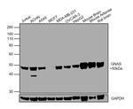 GNAS Antibody in Western Blot (WB)