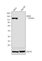 ROR2 Antibody in Western Blot (WB)