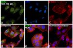 RRM2 Antibody