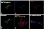 IGF2BP3 Antibody