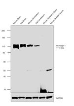 Neuroligin 1 Antibody in Western Blot (WB)