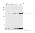 Cullin 4A Antibody in Western Blot (WB)