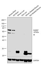 GAD67 Antibody in Western Blot (WB)