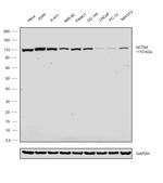 Alpha Actinin 4 Antibody