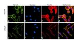 Alpha Actinin 4 Antibody in Immunocytochemistry (ICC/IF)