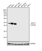 Cytokeratin 17 Antibody