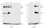 CD49d (Integrin alpha 4) Antibody in Western Blot (WB)