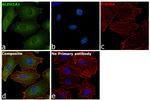 ALDH1A1 Antibody in Immunocytochemistry (ICC/IF)