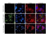 Apolipoprotein H Antibody