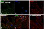 VE-cadherin Antibody in Immunocytochemistry (ICC/IF)