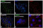 beta Catenin Antibody