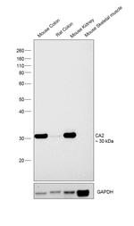 Carbonic Anhydrase II Antibody in Western Blot (WB)