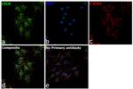 LDLR Antibody in Immunocytochemistry (ICC/IF)