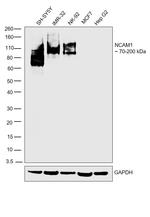 CD56 Antibody in Western Blot (WB)