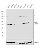 PAX3 Antibody in Western Blot (WB)