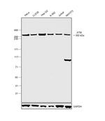 ATM Antibody in Western Blot (WB)