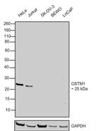 GSTM1 Antibody in Western Blot (WB)