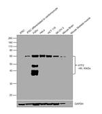 ATF2 Antibody in Western Blot (WB)