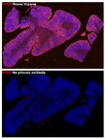 PCNA Antibody in Immunohistochemistry (Paraffin) (IHC (P))