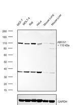 ABCG1 Antibody in Western Blot (WB)