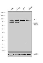 FOXO1 Antibody in Western Blot (WB)