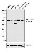 PKC beta-2 Antibody in Western Blot (WB)