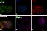 Cytokeratin 15 Antibody