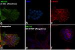 Cytokeratin 15 Antibody in Immunocytochemistry (ICC/IF)