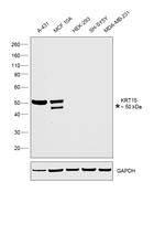 Cytokeratin 15 Antibody in Western Blot (WB)