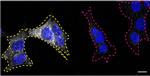 TSC2 Antibody in Immunocytochemistry (ICC/IF)