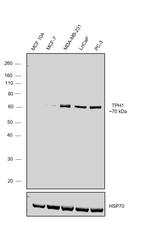 TPH1 Antibody in Western Blot (WB)