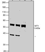 WT1 Antibody