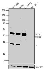 WT1 Antibody in Western Blot (WB)